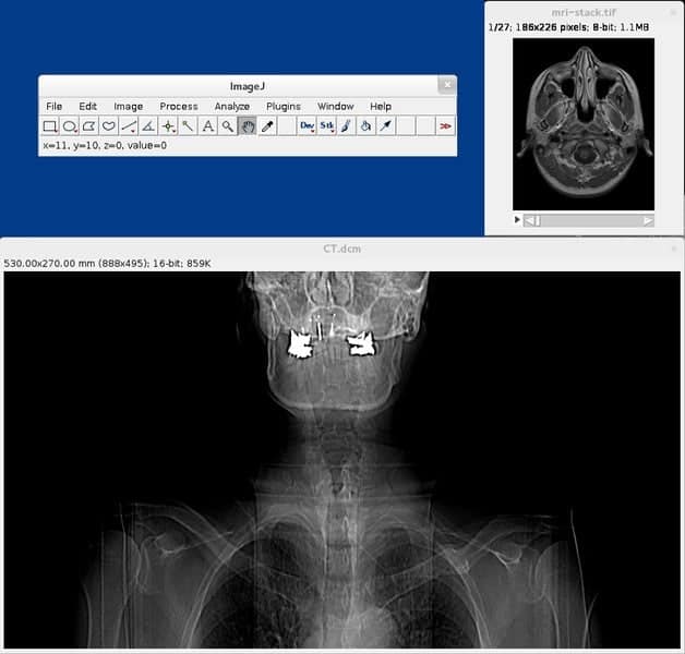 ImageJ Linux DICOM viewers