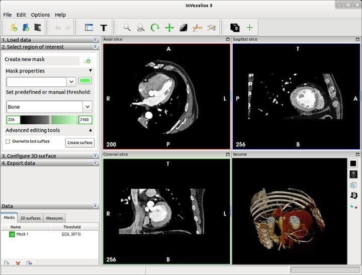 Invesalius tool