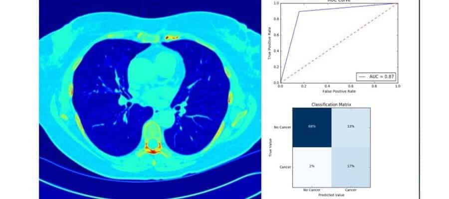 cancer-detection-by-iot